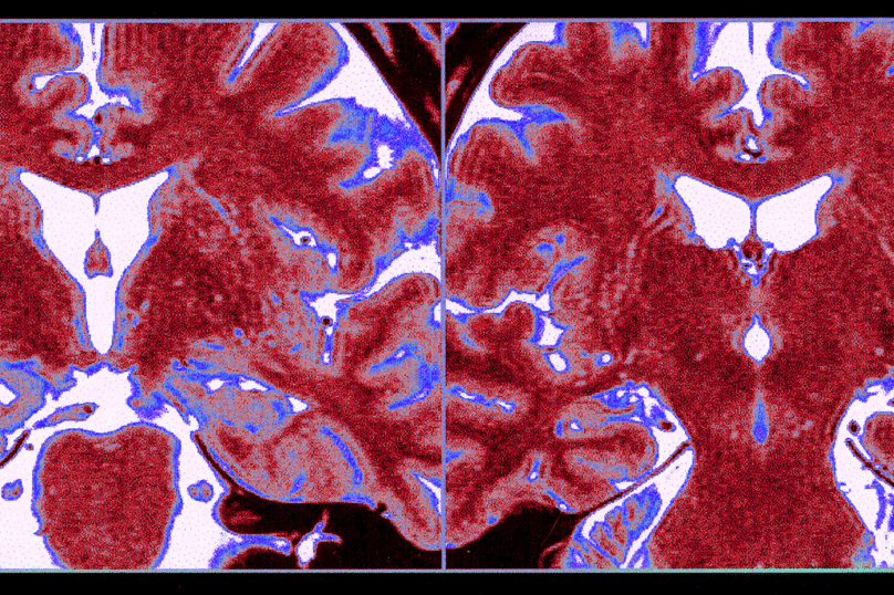 L’enfant et les neurosciences